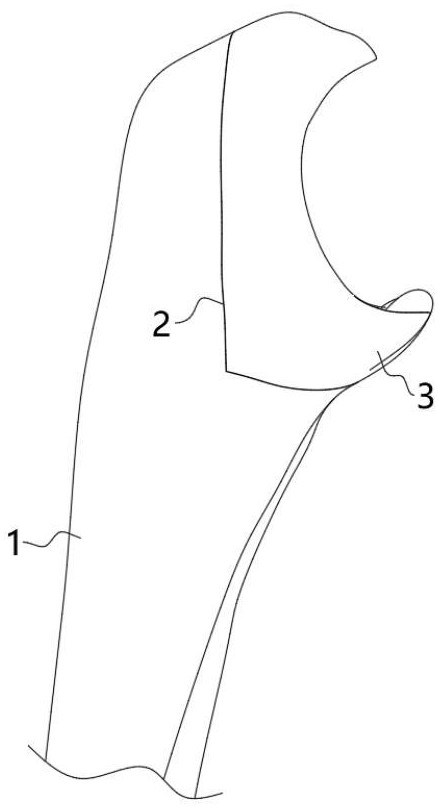 一种尺骨鹰嘴关节面表面假体及其操作方法与流程