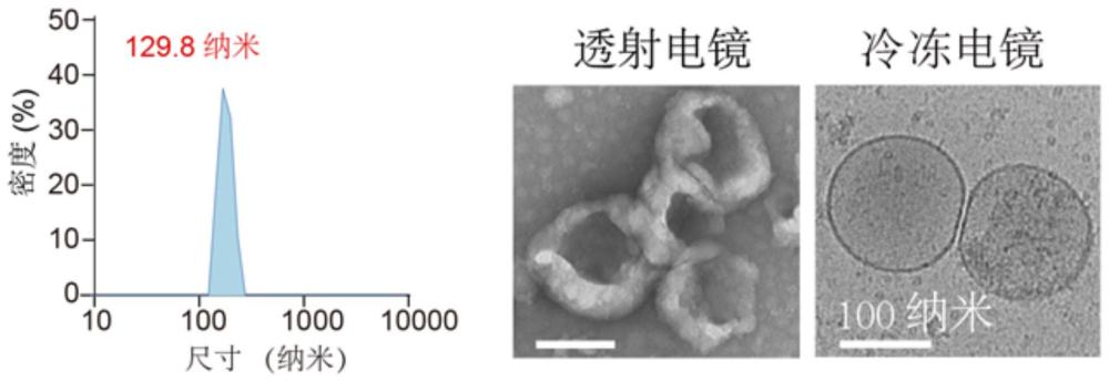 血小板外泌体的体外制备方法及其在抑制肿瘤中的应用与流程