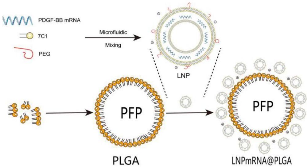 一种载PDGF-BB mRNA的纳米复合物及其制备方法与应用