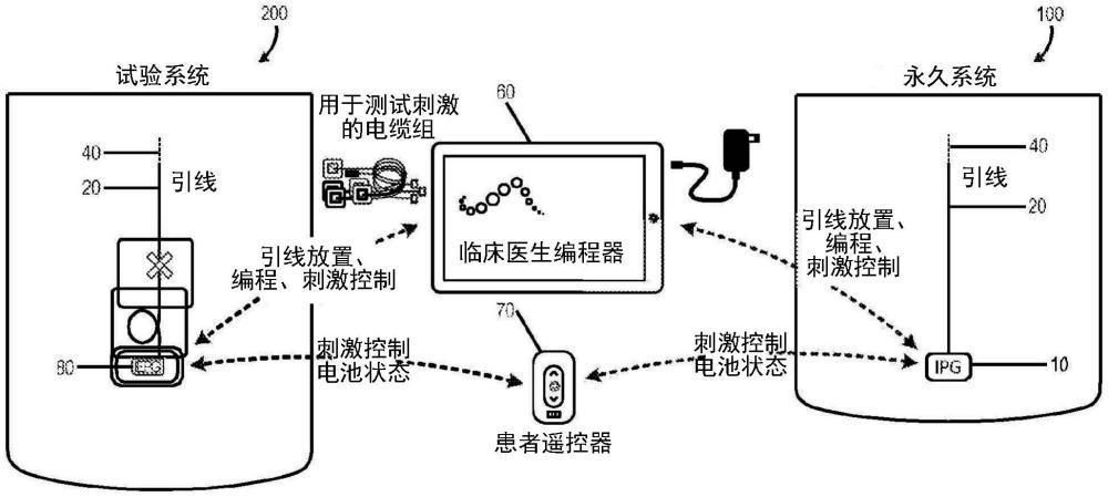 用于神经刺激器的接插件和天线的制作方法