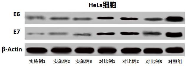 一种预防治疗HPV和宫颈癌的药物组合物及其制备方法与流程