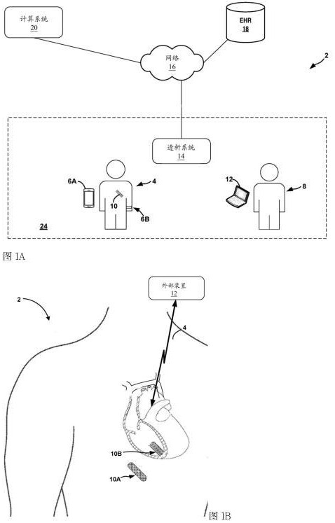 用于透析疗程的基于阻抗的校准的医疗装置系统的配置的制作方法